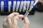 New Human Antibodies To Combat Ebola, Human Antibodies To Fight Ebola, new human antibodies to combat ebola, Ebola outbreak