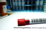 Hemophilia medication, Hemophilia among men, why are men likely to develop hemophilia, Episode