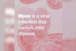 Mpox, mpox break down, mpox emergency again, Sweden
