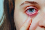 Conjunctivitis videos, Conjunctivitis latest, special measures to prevent conjunctivitis, Conjunctivitis