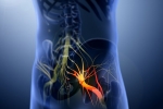Sciatica nerve, Sciatica, help yourself on sciatica, Natural remedies