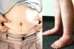 Water Retention health tips, Water Retention supplements, some effective ways to reduce water retention, Heart diseases