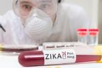 Zika Virus, Zika screening, fda expands zika screening to all us blood centers, Blood donation Zika Virus, Zika screening, fda expands zika screening to all us blood centers, Blood donation