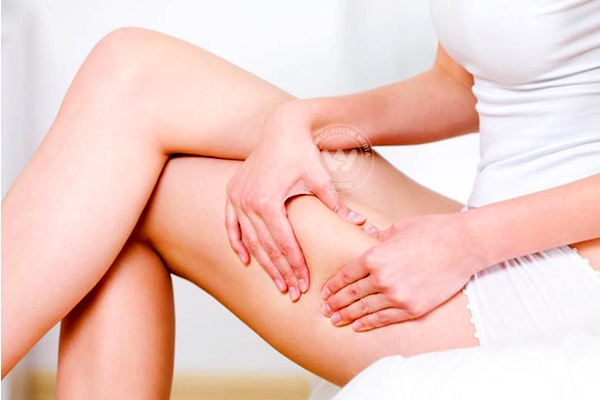 Minimizing Appearance Of Cellulite},{Minimizing Appearance Of Cellulite