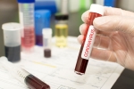 vaccine, WHO, covid 19 vaccine likely by 2021 who, Chloroquine