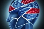 Study, Research, cooling treatment treats brain injuries and stroke says study, Head injury Study, Research, cooling treatment treats brain injuries and stroke says study, Head injury