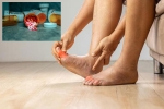 Gout Drugs news, Gout Drugs updates, gout drugs may cut the risk of heart attack, Attack Gout Drugs news, Gout Drugs updates, gout drugs may cut the risk of heart attack, Attack