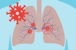 Covid-19, virus, how does covid 19 affect different parts of the body, Neurology
