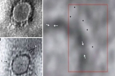 Indian Scientists reveal images of the novel coronavirus under a microscope