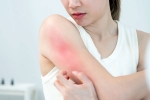 Skin Problems, Skin Problems Treatment experts, skin problems that you can treat naturally, Spots
