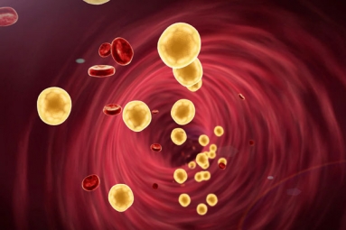 Tips to Lower Cholesterol when Statins don&#039;t Work