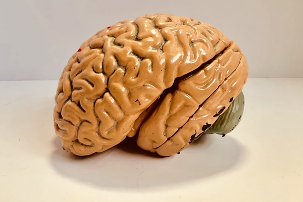 Indians Have Smaller Brains, A Study Revealed